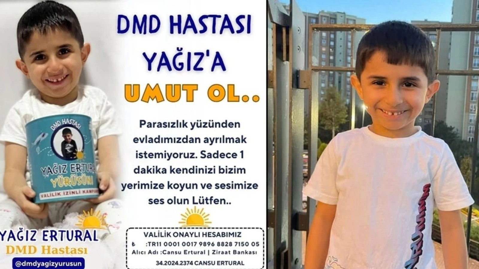 DMD hastası Yağız Ertural için yardım çağrısı!;